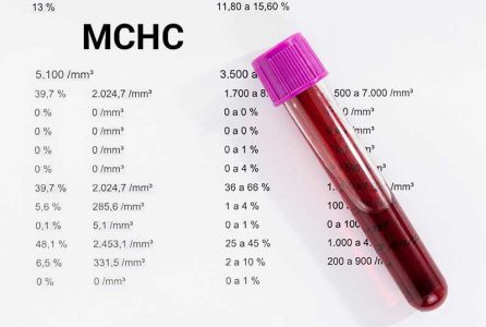 میزان نرمال MCHC در آزمایش خون چقدر است؟‌