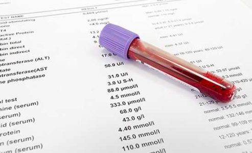 میزان نرمال MCHC در آزمایش خون چقدر است؟‌