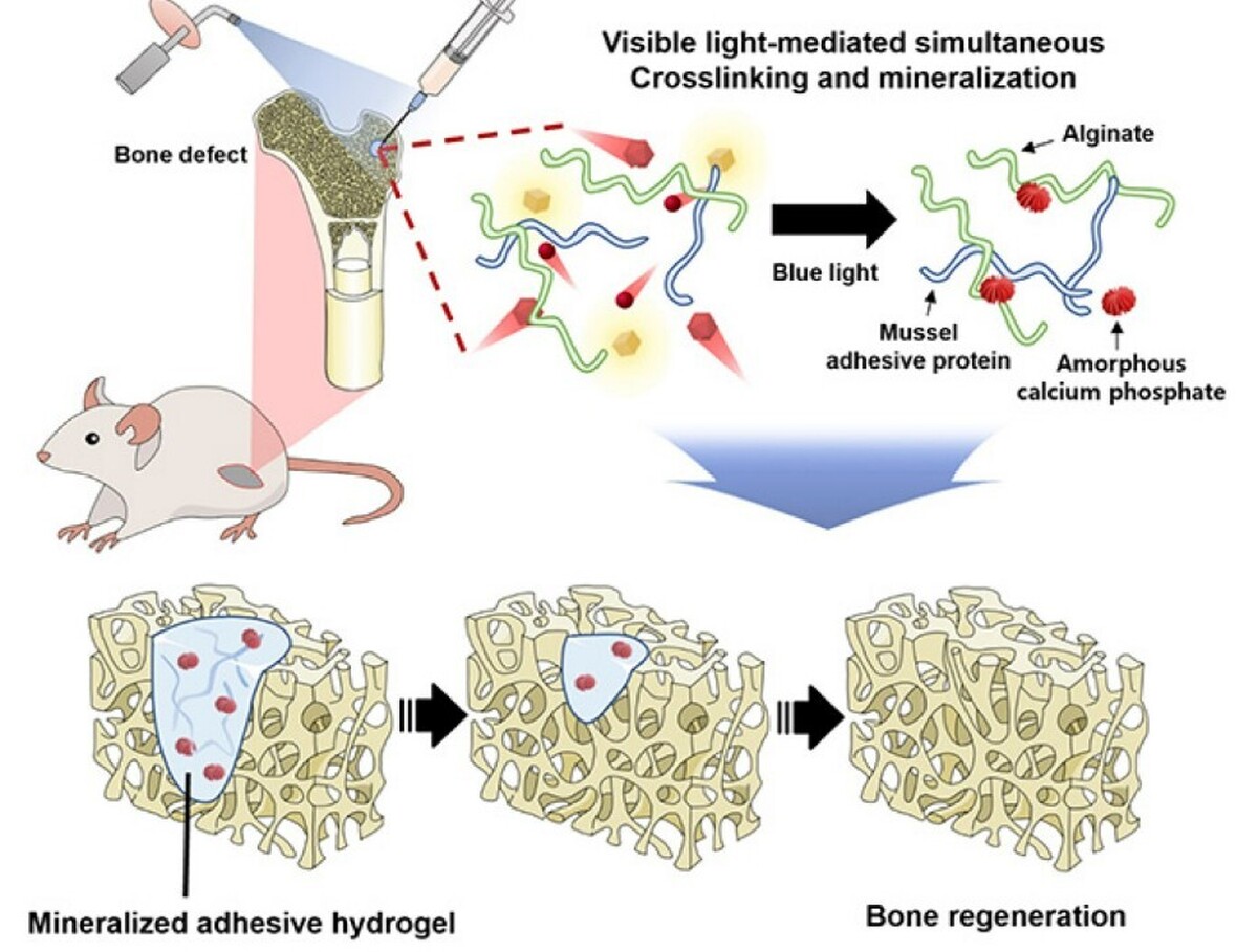 ترمیم استخوان‌های آسیب دیده با هیدروژل تزریقی نوری 