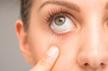 ردگیری کوچک شدن مغز از طریق چشم ها