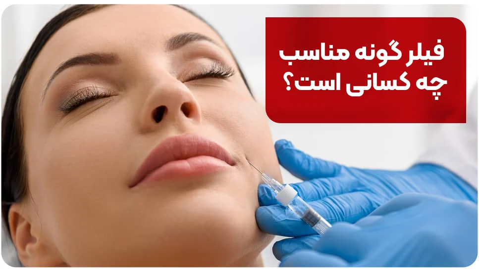 فیلر گونه مناسب چه کسانی است؟